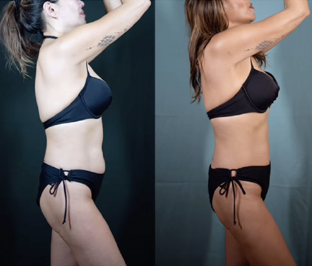 Before and After