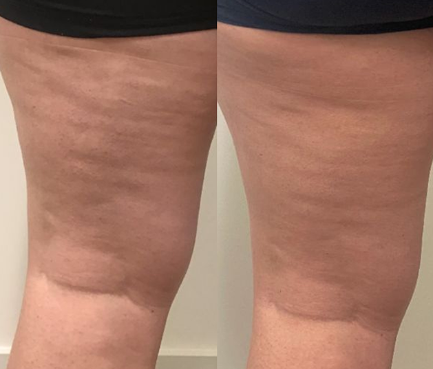 Before and After
