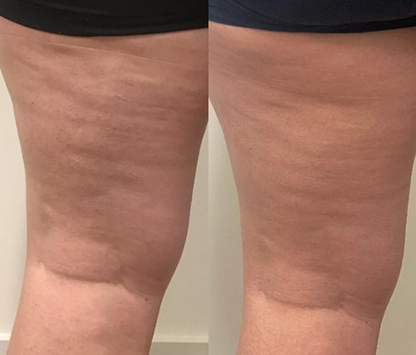 CHOOSE YOU CELLULITE REDUCING COFFEE SCRUB
