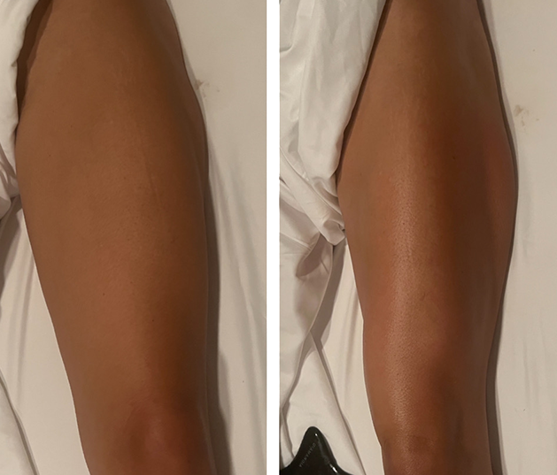 Before and After